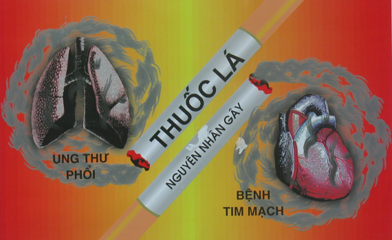 Thuốc lá – "sát thủ thầm lặng" đe dọa sức khỏe cộng đồng- Ảnh 1.