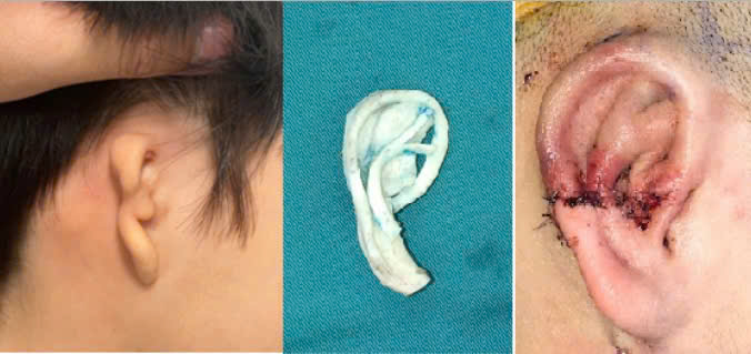 Hành trình chữa lành dị tật: Từ kỹ thuật đến trái tim tận tâm- Ảnh 2.