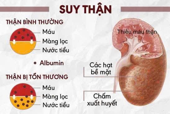 Những sai lầm nguy hiểm khi người bệnh tự ý điều trị suy thận- Ảnh 1.