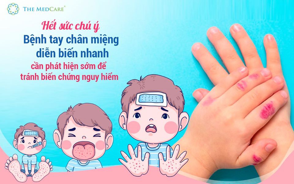 Vì sức khỏe của trẻ, hãy chung tay phòng chống bệnh tay chân miệng