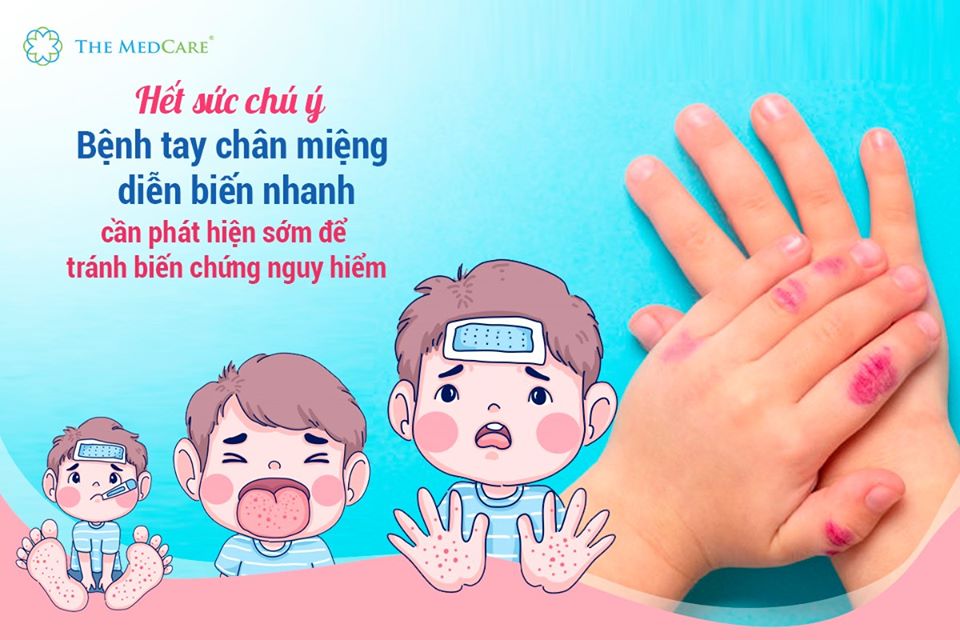 Vì sức khỏe của trẻ, hãy chung tay phòng chống bệnh tay chân miệng- Ảnh 1.