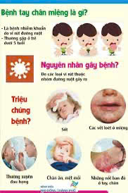 CÁCH PHÒNG, CHỐNG BỆNH TAY CHÂN MIỆNG- Ảnh 5.