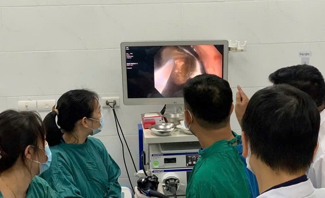 Bệnh viện Đa khoa huyện Thường Tín: Gắp thành công dị vật bàn chải đánh răng trong dạ dày bằng nội soi gây mê- Ảnh 1.