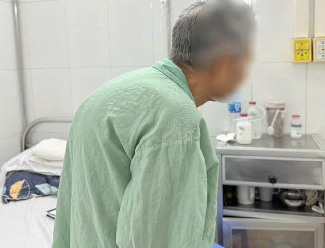 Phẫu thuật đặc biệt cho bệnh nhân ung thư dạ dày bị gù vẹo cột sống nặng- Ảnh 1.