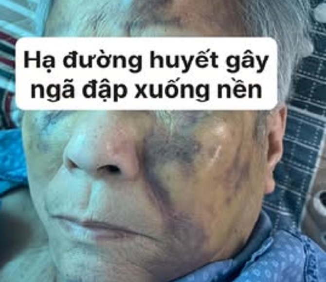 https://soyte.hanoi.gov.vn/documents/5064476/9014119/488592402_4010886252480315_4862501562708277556_n.jpg/b289266c-2f02-4b9b-bcc0-c7f2f03856d8?t=1754535075587