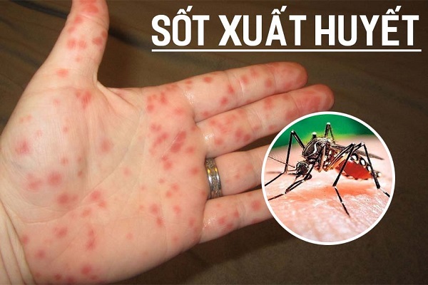 Xã Tiến Thắng tăng cường các biện pháp phòng chống sốt xuất huyết
- Ảnh 1.