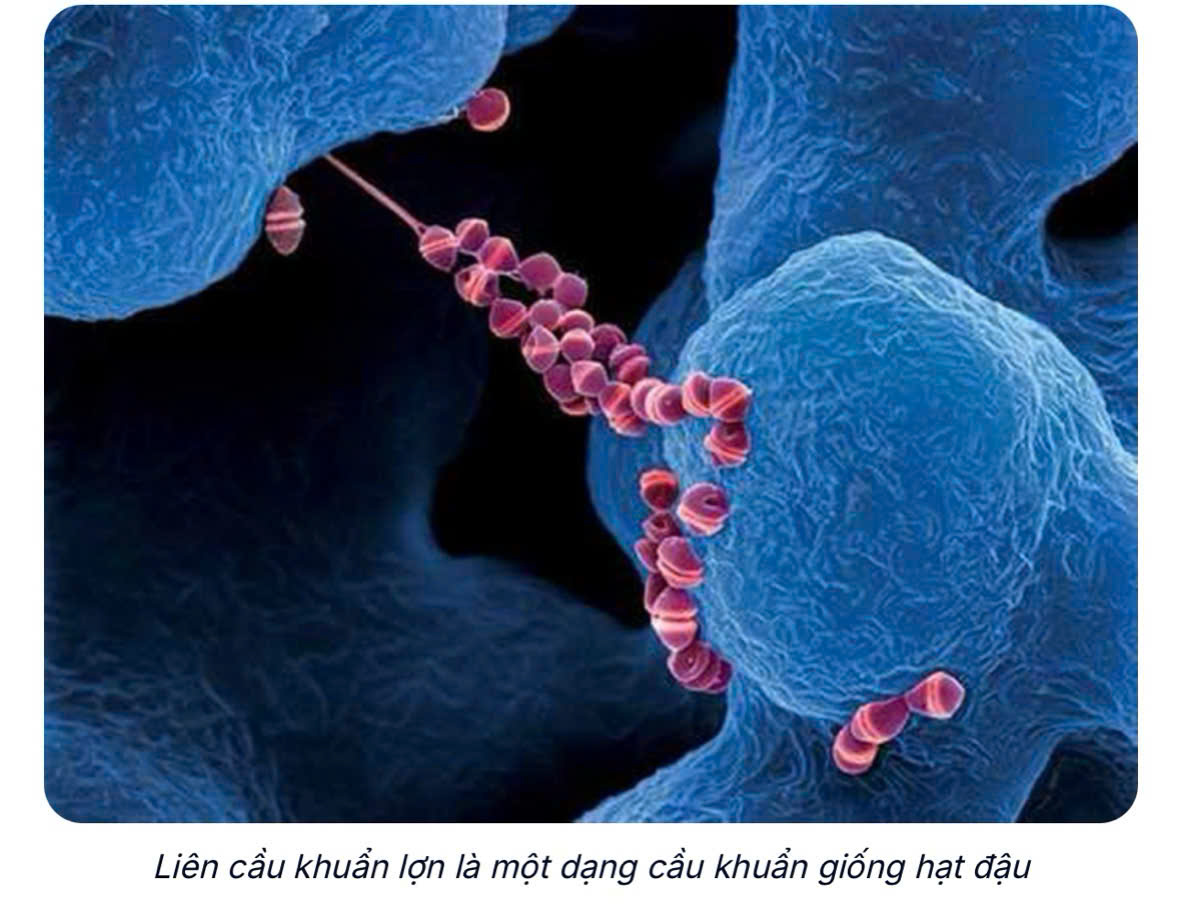 CHỦ ĐỘNG PHÒNG CHỐNG BỆNH LIÊN CẦU LỢN