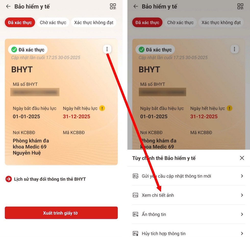 Cách xử lý khi thẻ BHYT điện tử hết hạn hoặc thông tin trên VNeID sai lệch- Ảnh 3.