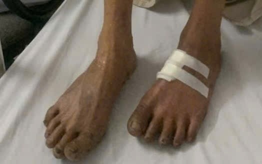 Đau chân khi đi bộ - cảnh báo bệnh động mạch chi dưới- Ảnh 1.