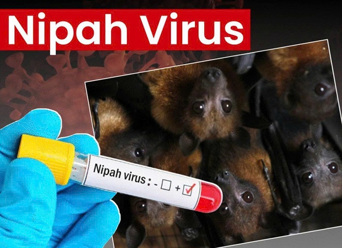 Dịch bệnh do vi rút Nipah và khuyến cáo của ngành y tế- Ảnh 1.