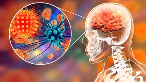 Cảnh báo khẩn: Tuyệt đối không ăn trái cây có dấu hiệu bị động vật cắn dở để phòng vi rút Nipah- Ảnh 1.