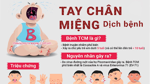 Dấu hiệu nhận biết bệnh Tay chân miệng- Ảnh 1.