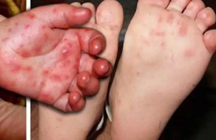 Tổ chức đợt cao điểm “Vệ sinh môi trường, khử khuẩn chủ động phòng, chống bệnh Tay chân miệng” trên địa bàn xã đợt tháng 3, 4 năm 2026- Ảnh 1.