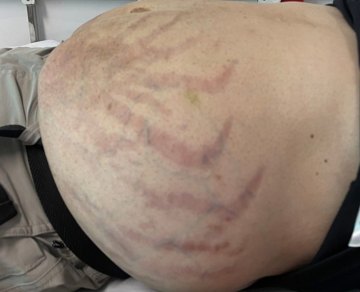 Lạm dụng corticoid – hiểm họa cho sức khỏe- Ảnh 1.