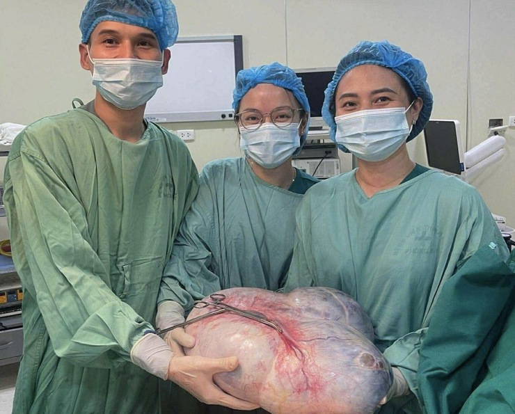 Bệnh viện Thanh Nhàn phẫu thuật thành công cho bệnh nhân nữ có khối u buồng trứng khủng lồ lên tới 15kg- Ảnh 1.