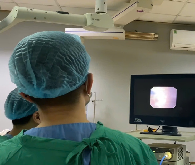 Bệnh viện đa khoa Phú Xuyên đưa vào sử dụng máy tán sỏi công nghệ laser hiện đại- Ảnh 1.