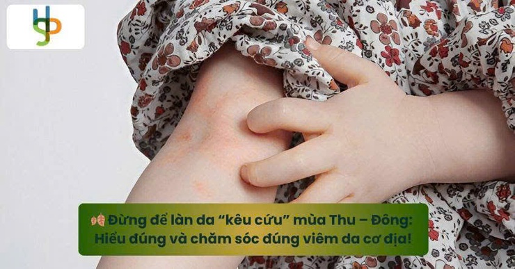 Đừng để làn da "kêu cứu" trong mùa Thu – Đông: hiểu và chăm sóc đúng để kiểm soát viêm da cơ địa- Ảnh 1.