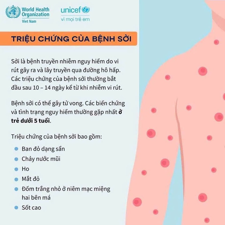Cách phòng ngừa Bệnh Sởi- Ảnh 2.