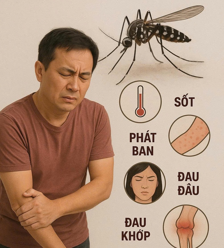 Bệnh chikungunya: Những thông tin có thể bạn chưa biết- Ảnh 1.