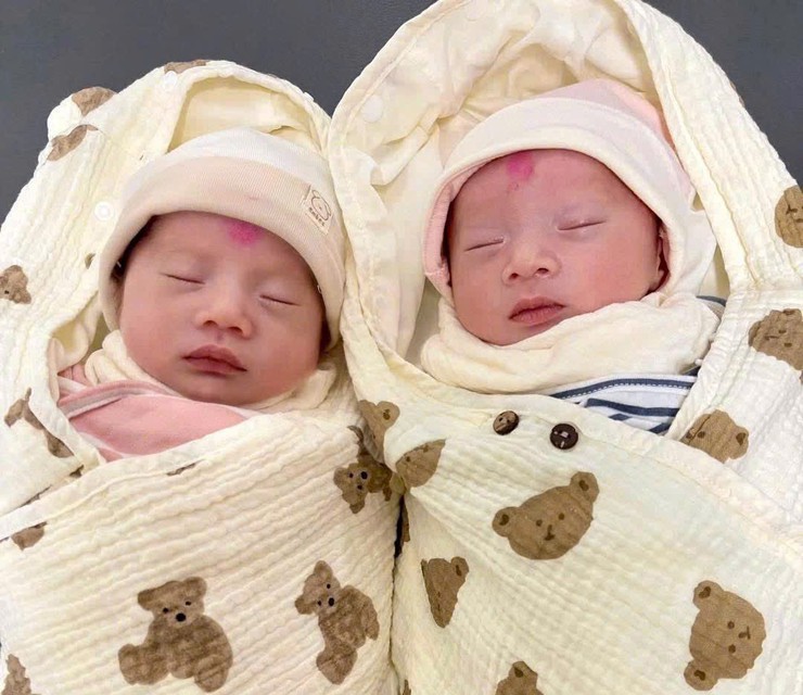 Vượt qua lo lắng thai có bất thường bẩm sinh, sản phụ mang song thai sinh con an toàn tại Bệnh viện Phụ Sản Hà Nội- Ảnh 1.