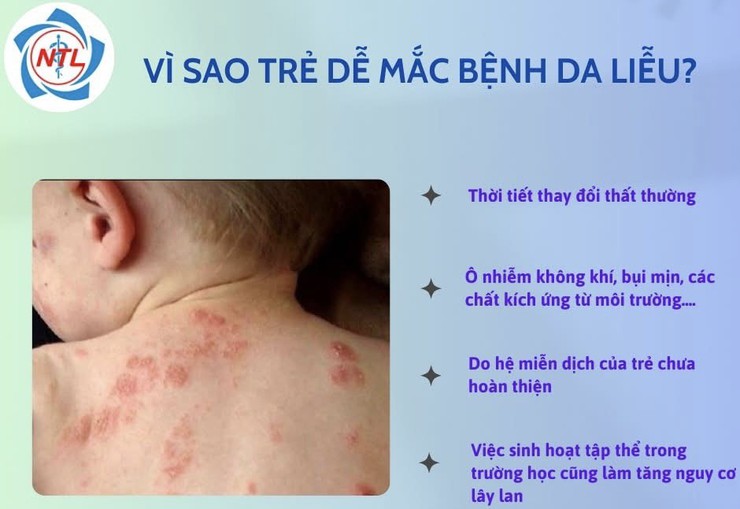 Cảnh giác với bệnh da liễu ở trẻ nhỏ- Ảnh 1.