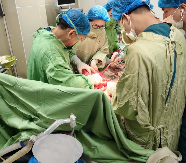 Bệnh viện Phụ sản Hà Nội: Phẫu thuật lấy khối u xơ tử cung khổng lồ lan rộng đến hạ sườn- Ảnh 1.