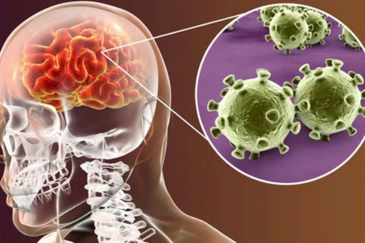 Viêm màng não mô cầu BC - Nguy cơ và cách phòng ngừa hiệu quả- Ảnh 1.