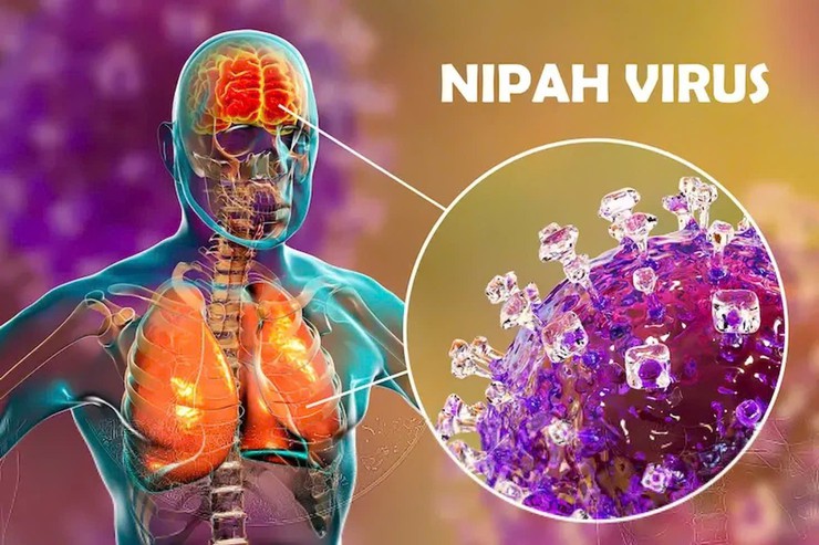 Khuyến cáo phòng chống dịch bệnh do vi rút Nipah- Ảnh 1.