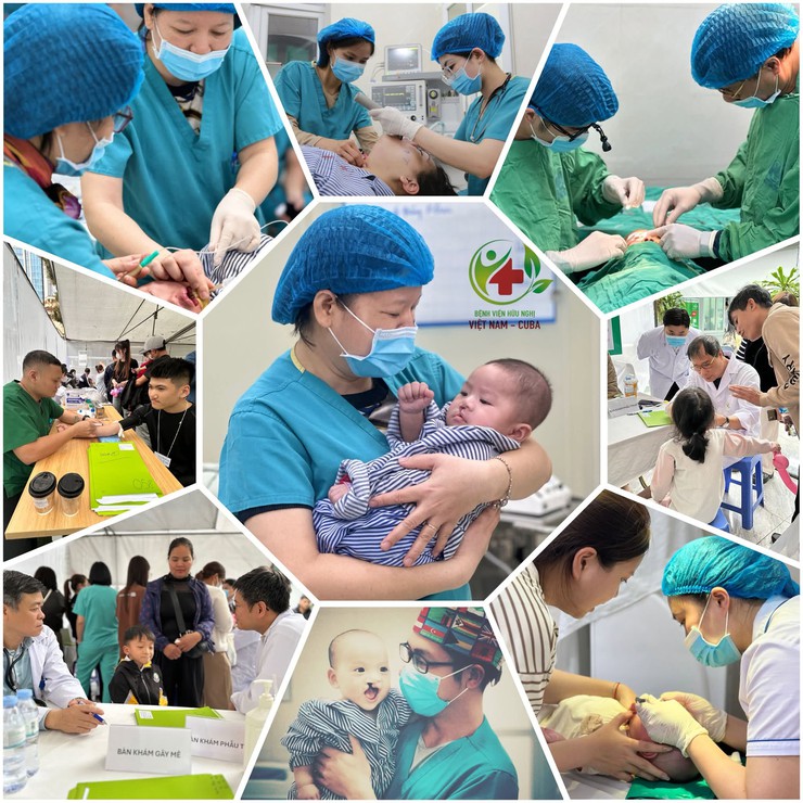 Bệnh viện Hữu nghị Việt Nam - Cu Ba phối hợp triển khai chương trình Phẫu thuật Nụ cười miễn phí cho trẻ em - Ảnh 1.