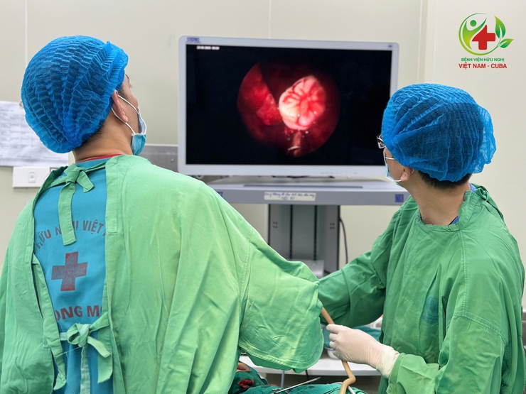 Những biến chứng răng mọc lạc chỗ vào xoang hàm- Ảnh 1.