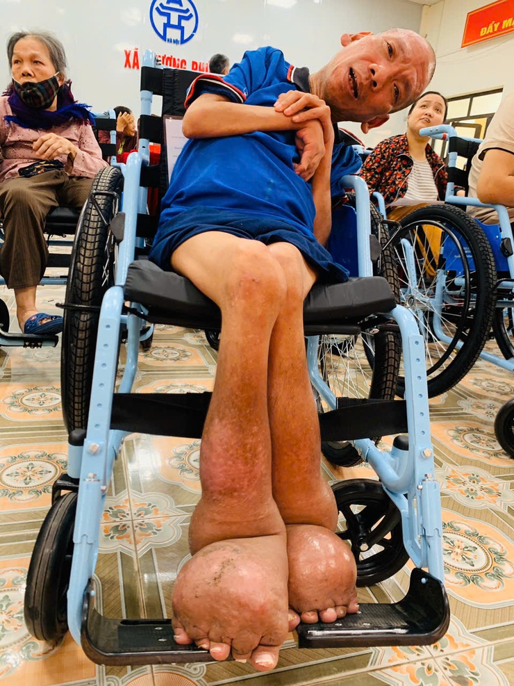 Thượng Phúc trao tặng 15 xe lăn, tiếp thêm nghị lực cho người khuyết tật- Ảnh 2.