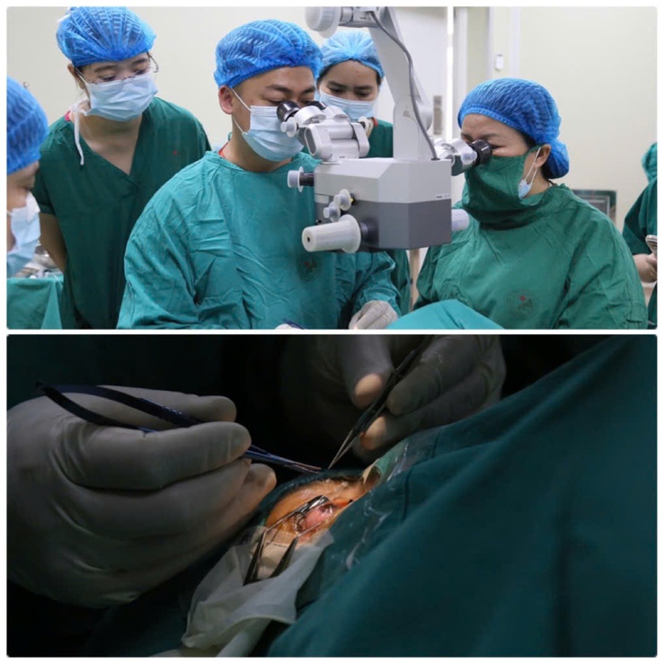 Bệnh viện đa khoa Đức Giang: Lần đầu triển khai kỹ thuật ghép giác mạc xuyên, tiến tới làm chủ ghép đa tạng- Ảnh 1.