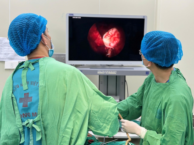 Người dân đừng chủ quan với triệu chứng chảy dịch tai kéo dài- Ảnh 1.