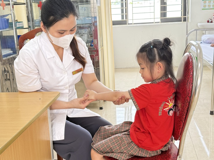 Chủ động phòng bệnh tay chân miệng từ sớm, từ xa tại các trường học- Ảnh 1.