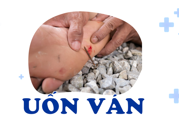 Bệnh uốn ván: Nguyên nhân, dấu hiệu và cách phòng ngừa- Ảnh 2.