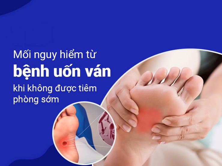 Bệnh uốn ván: Nguyên nhân, dấu hiệu và cách phòng ngừa- Ảnh 3.