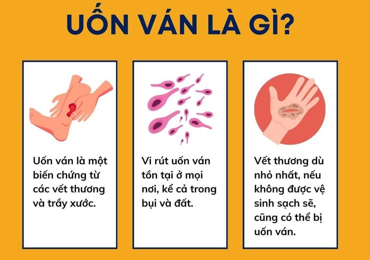 Bệnh uốn ván: Nguyên nhân, dấu hiệu và cách phòng ngừa- Ảnh 1.