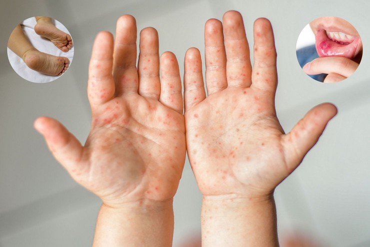 Phú Xuyên triển khai đợt cao điểm vệ sinh môi trường phòng chống bệnh tay chân miệng năm 2026- Ảnh 5.