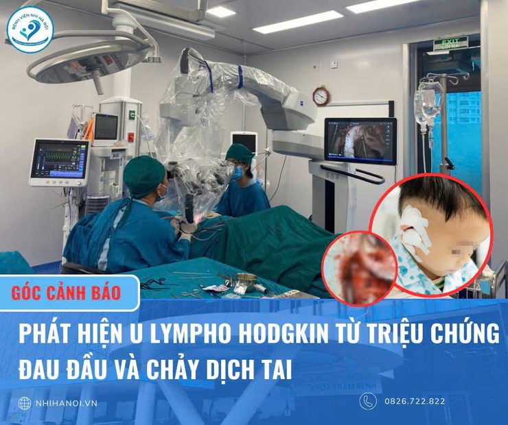 Bệnh viện Nhi Hà Nội: Cảnh báo U lympho hodgkin ở trẻ- Ảnh 1.