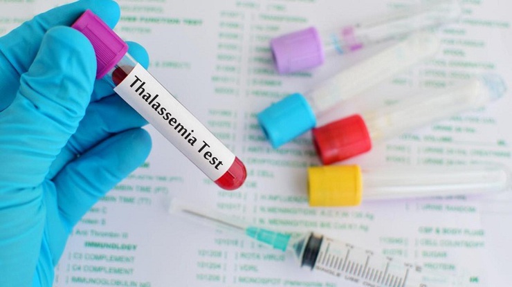 Thalassemia – bệnh di truyền nguy hiểm nhưng hoàn toàn có thể phòng ngừa- Ảnh 1.
