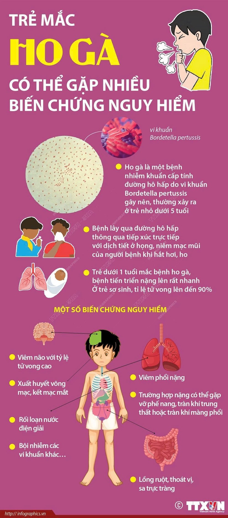 BÀI TUYÊN TRUYỀN: PHÒNG, CHỐNG BỆNH HO GÀ- Ảnh 1.