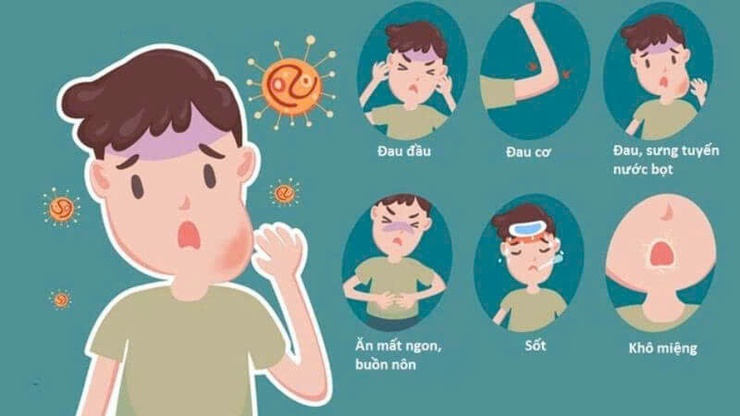 Nhận biết sớm bệnh quai bị để phòng ngừa biến chứng và hạn chế lây lan trong cộng đồng- Ảnh 1.