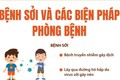 Hà Nội triển khai chiến dịch tiêm vaccine sởi cho trẻ từ 1 - 5 tuổi