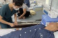 Chiếc tăm gần 7cm cắm sâu trong dạ dày gây nguy hiểm đến tính mạng được lấy ra kịp thời