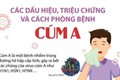 BÀI TUYÊN TRUYỀN VỀ CẢNH BÁO GIA TĂNG CÚM MÙA