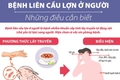 Các thông điệp phòng chống bệnh liên cầu lợn ở người
