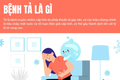 Bộ Y tế thông tin và khuyến cáo về bệnh Tả