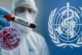 Phòng chống bệnh do Ebola Virus
