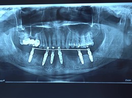 Thực trạng sức khỏe răng miệng cần được quan tâm đúng mức