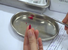 Triển khai uống VitaminA trên toàn thành phố